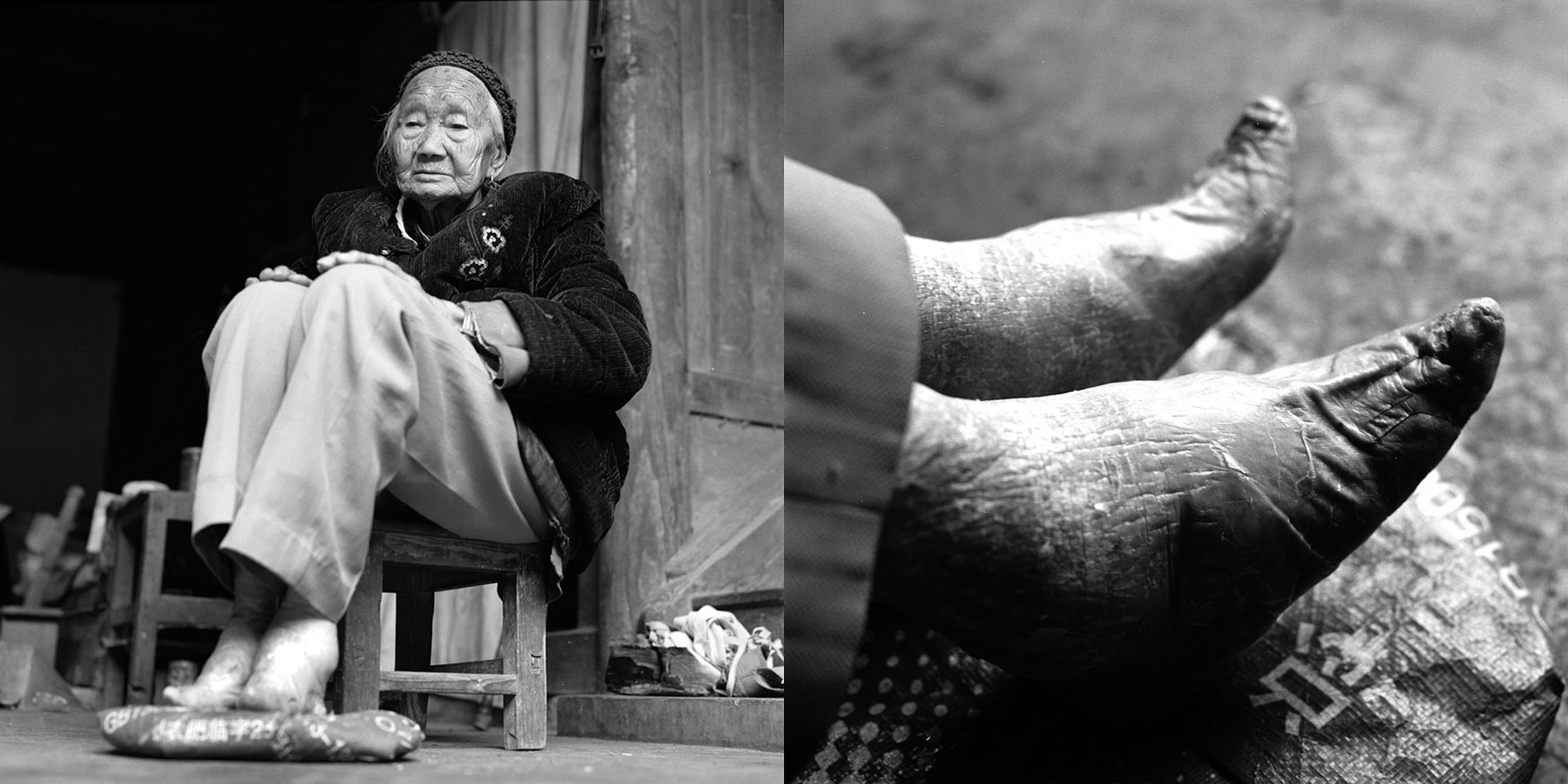 سنت بستن پاهای زنان در چین