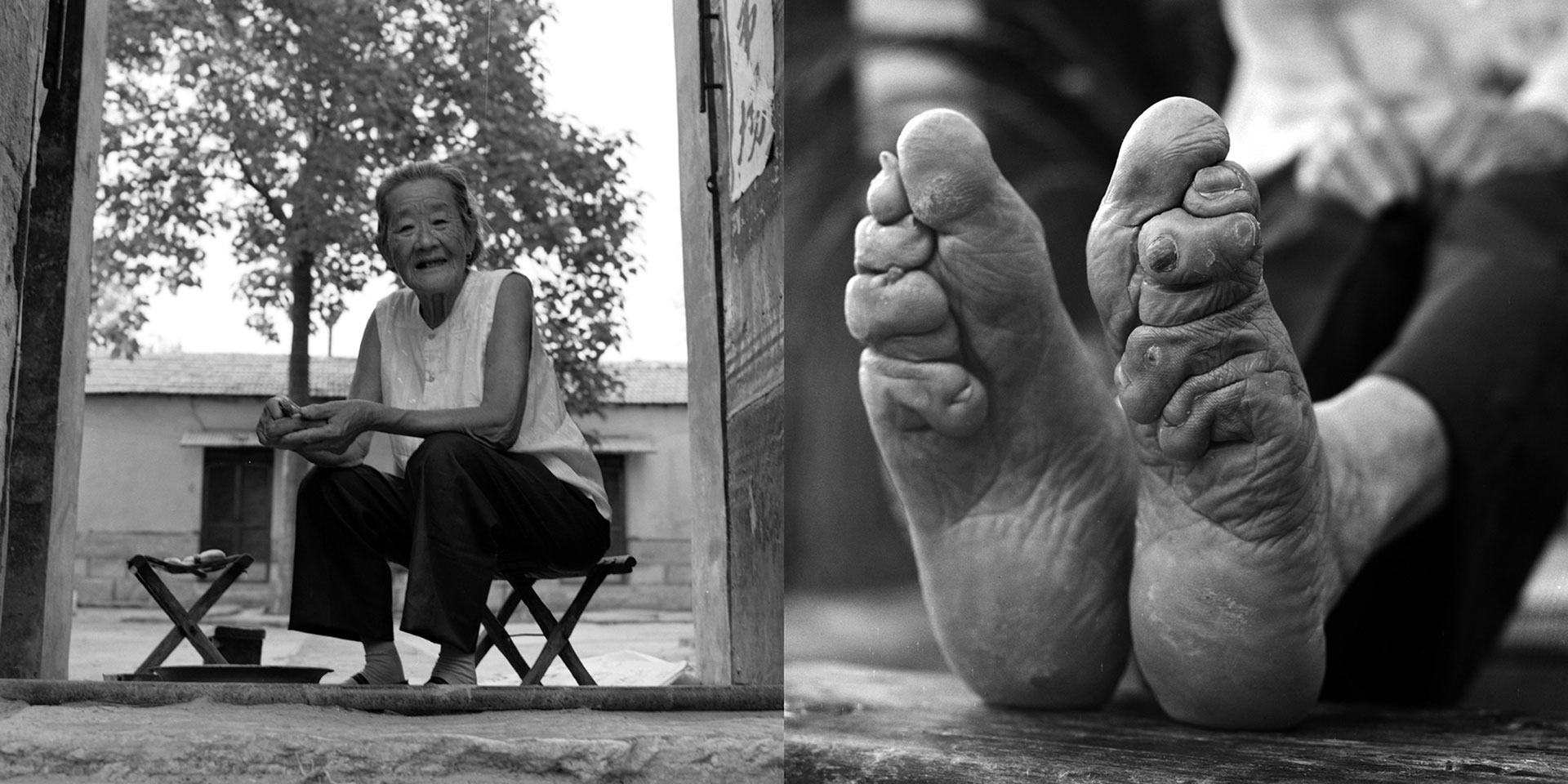 سنت بستن پاهای زنان در چین