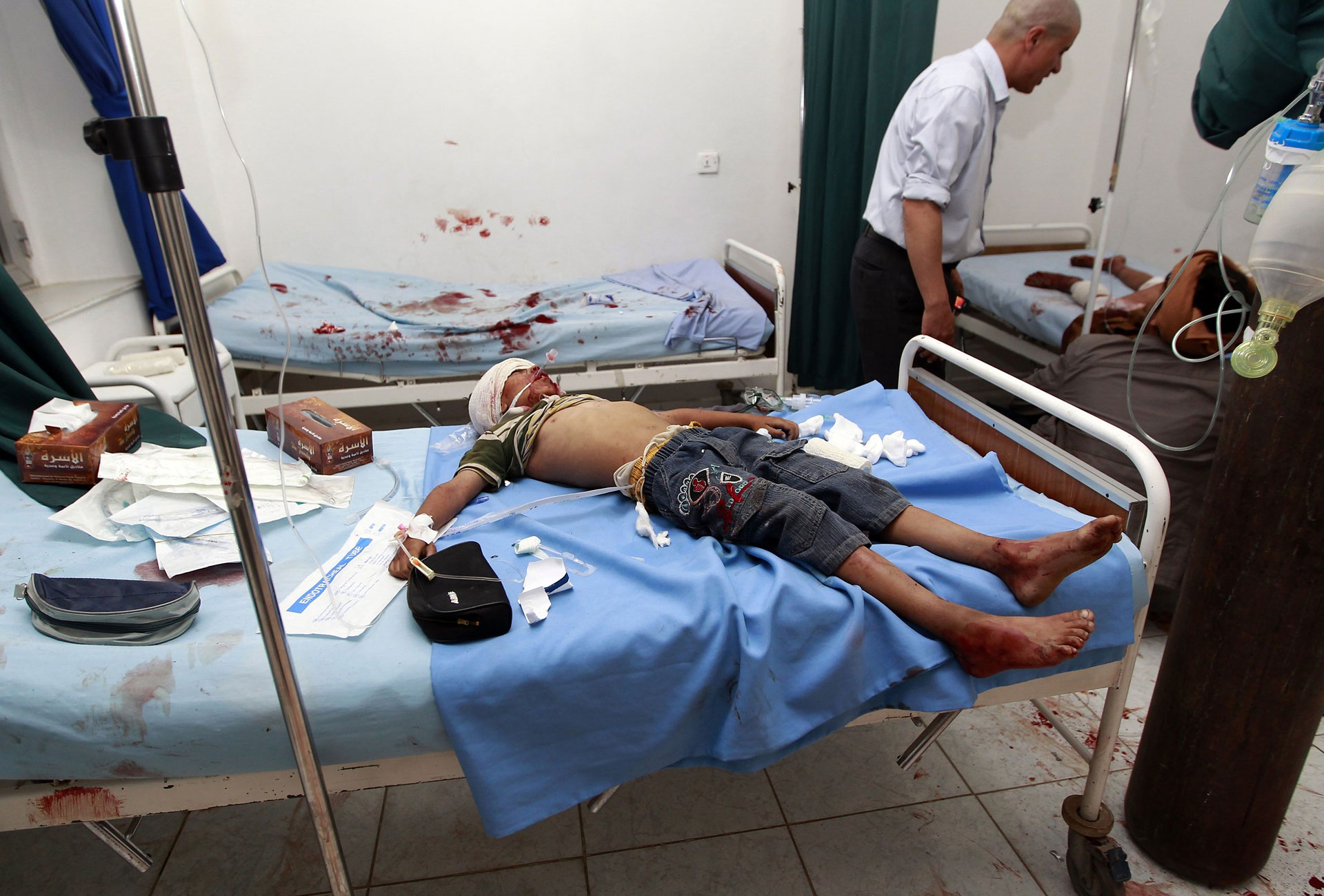 کودک مجروح شده در جریان بمب گذاری انتحاری در مسجد شیعیان